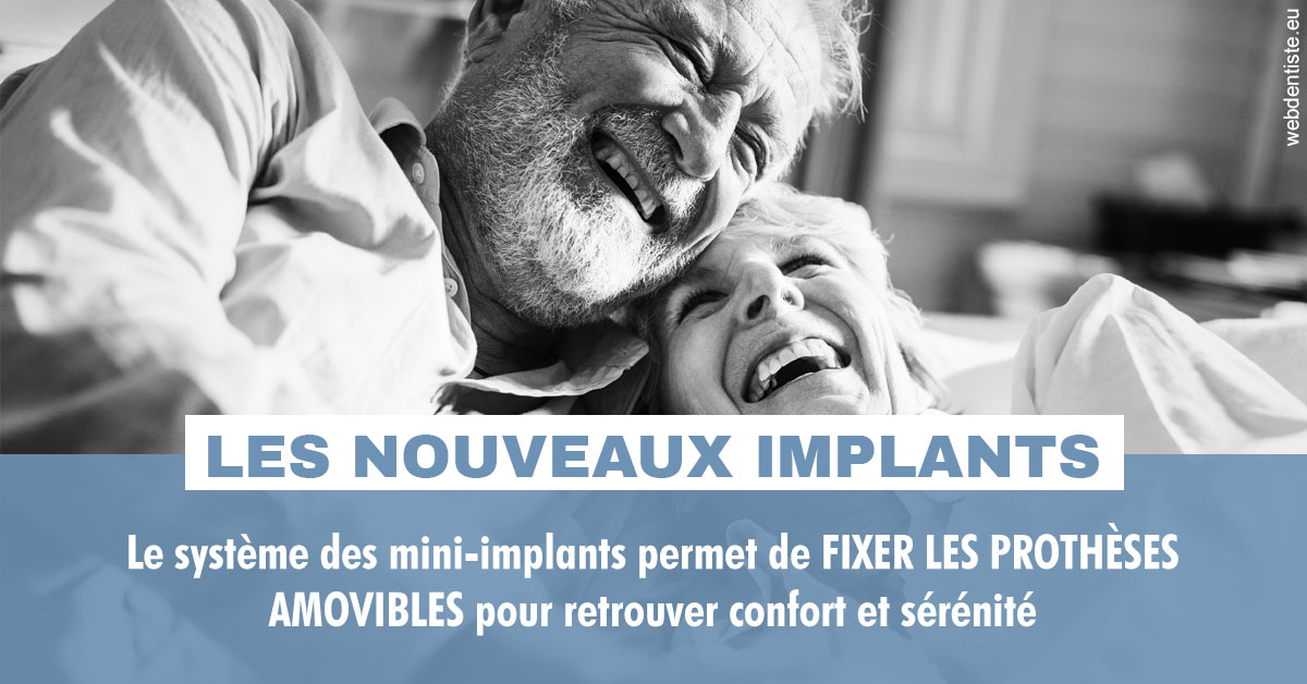 https://www.hygident-colin.fr/Les nouveaux implants 2