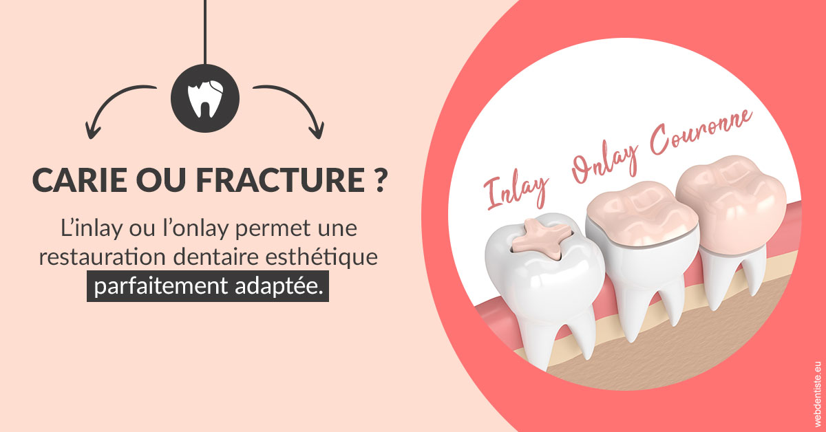 https://www.hygident-colin.fr/T2 2023 - Carie ou fracture 2