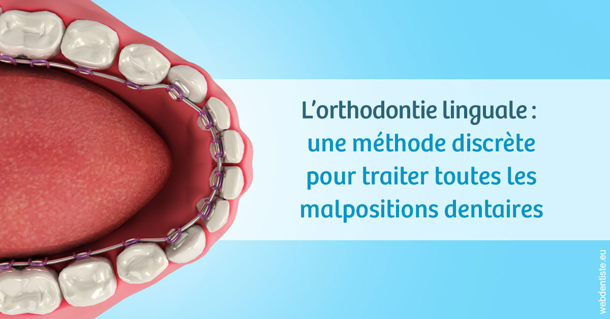 https://www.hygident-colin.fr/L'orthodontie linguale 1