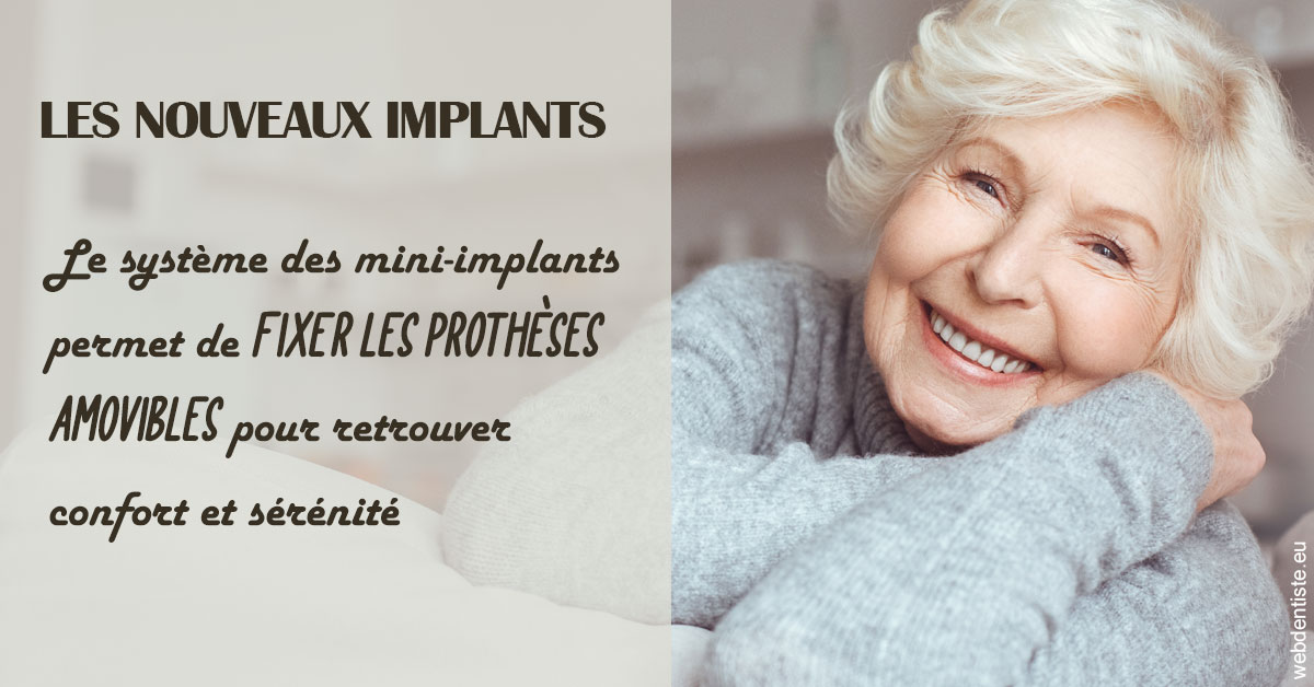 https://www.hygident-colin.fr/Les nouveaux implants 1
