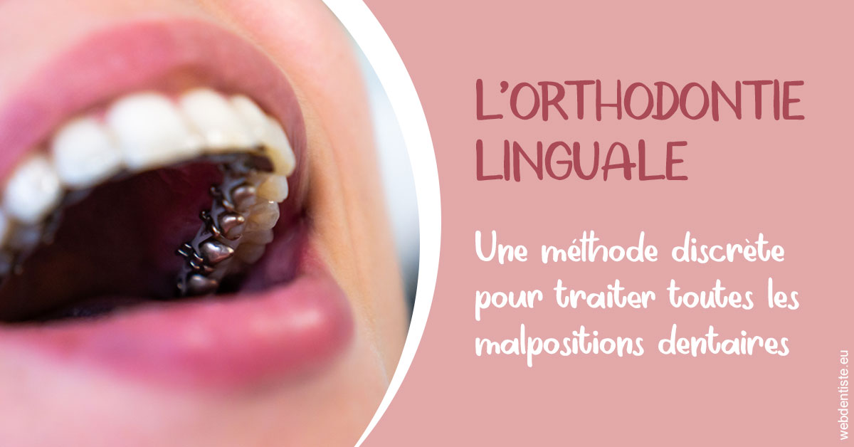 https://www.hygident-colin.fr/L'orthodontie linguale 2