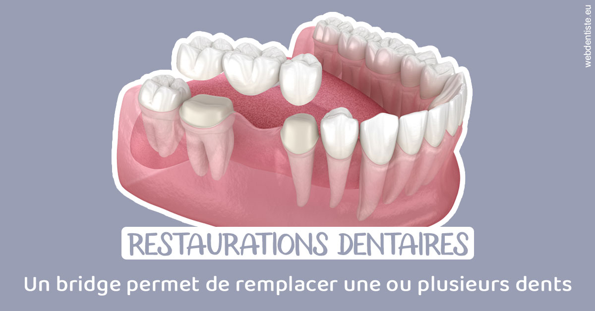 https://www.hygident-colin.fr/Bridge remplacer dents 1