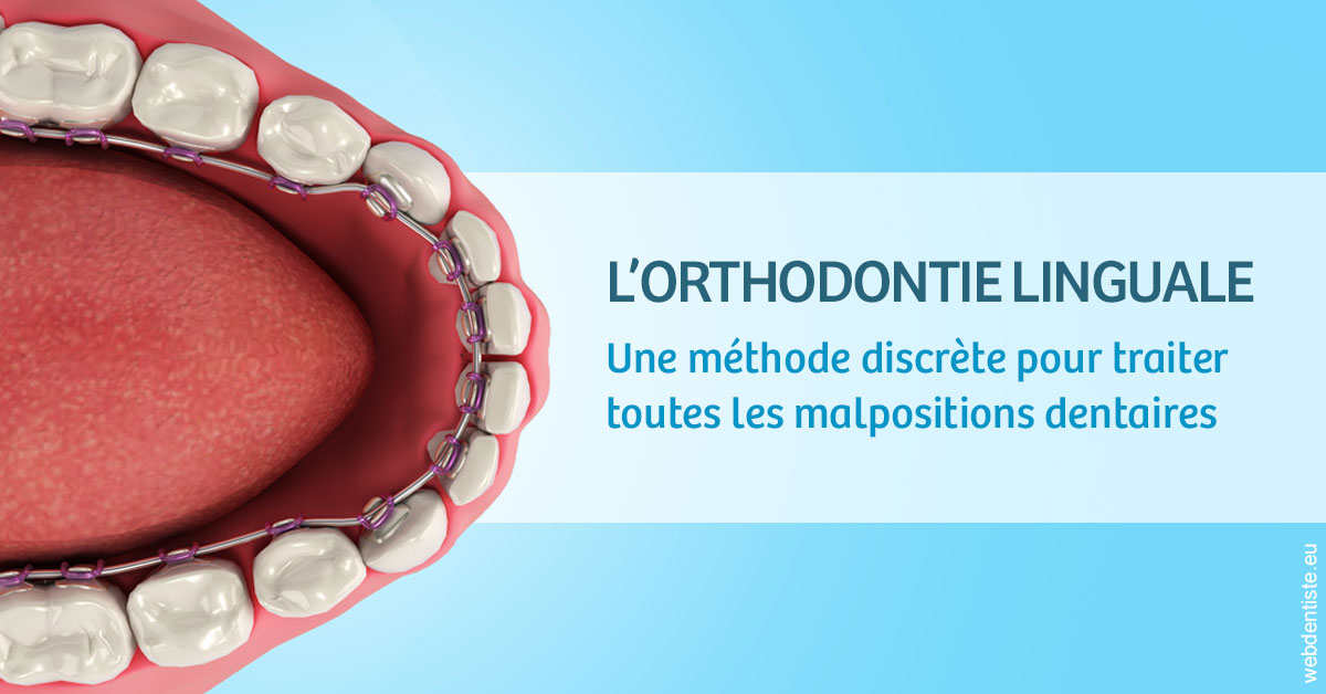 https://www.hygident-colin.fr/L'orthodontie linguale 1