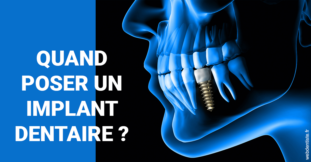 https://www.hygident-colin.fr/Les implants 1