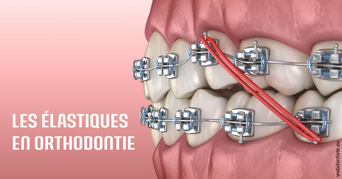 https://www.hygident-colin.fr/Elastiques orthodontie 2