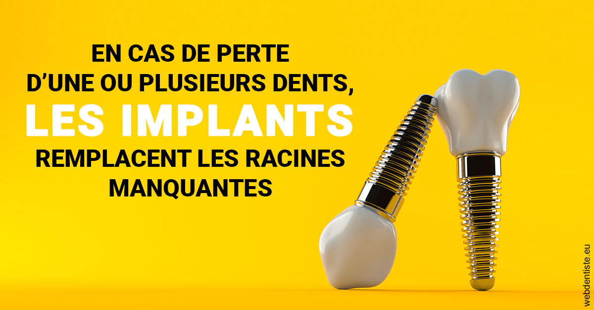 https://www.hygident-colin.fr/Les implants 2